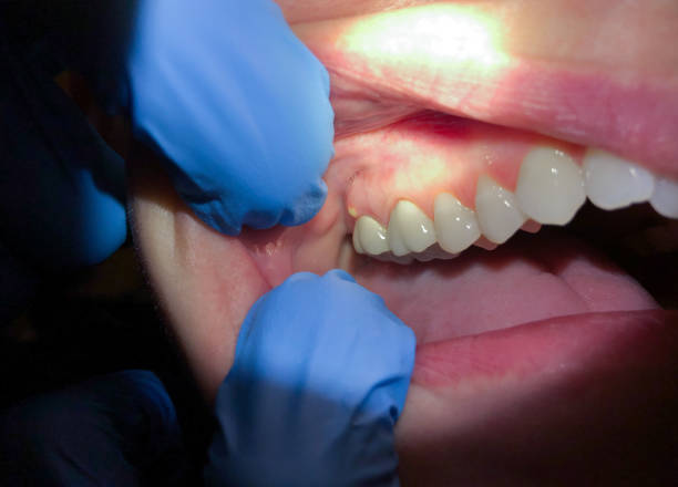 Best Emergency Orthodontic Repairs in Baldwin, MI
