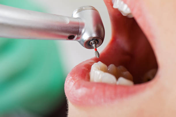 Best Emergency Dental Care for Trauma or Injury in Baldwin, MI